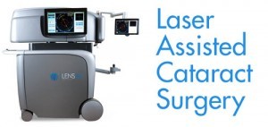 Laser Assisted Cataract Surgery
